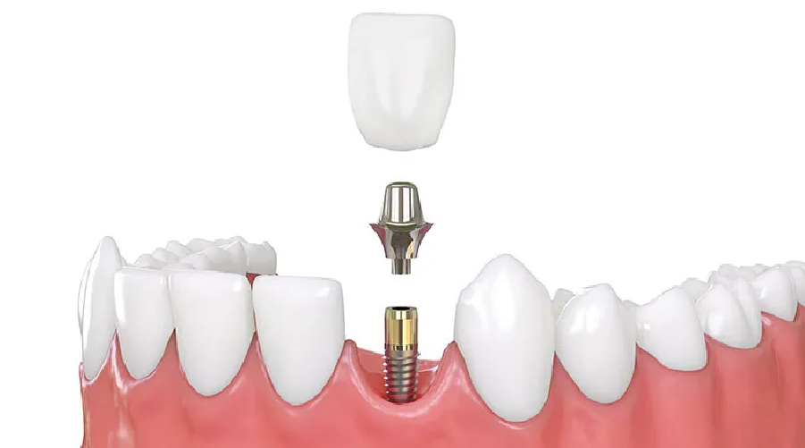 Service Image